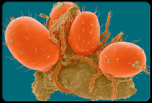 Front Immunol：血吸虫病相关肺动脉高压揭示了小鼠肠肺微生物组的破坏和内保护性 Caveolin-1/BMPR2 表达的减少