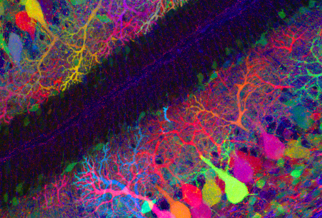 一文了解神经干细胞稀缺性和重要性