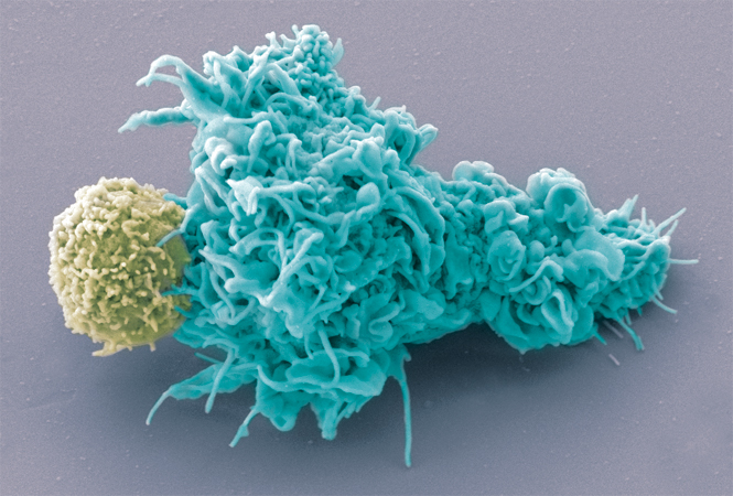 Mol Cancer：CAR T治疗套细胞淋巴瘤的综述