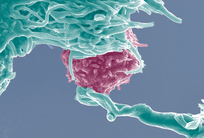 Science：一箭双雕，CD74蛋白可同时抑制埃博拉和新冠病毒