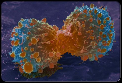 FDA批准首个治疗复发或难治性大B细胞淋巴瘤患者的口服药物：核出口抑制剂<font color="red">XPOVIO</font>