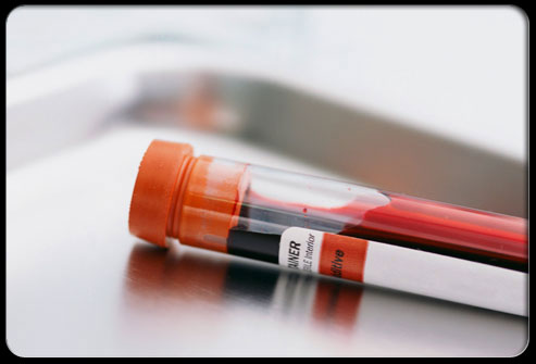 英国血液学学会指南：严重血红蛋白病的诊断和筛查指南