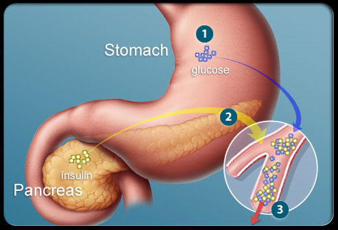 根据胃肠道症状评定量表(GSRS)快速了解胃肠道近期状况