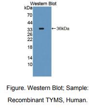 人胸苷酸合成酶(TYMS)多克隆抗体