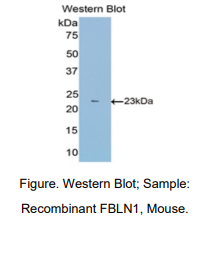 小鼠衰老关键蛋白1(FBLN1)多克隆抗体