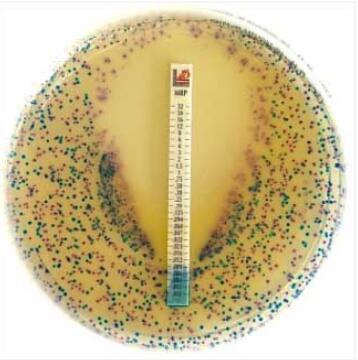 https://img.medsci.cn/a153e50aaab88627e141f44fc1db1a504d4e5bb08eafa6e013bea961dcc7ad69.jpg