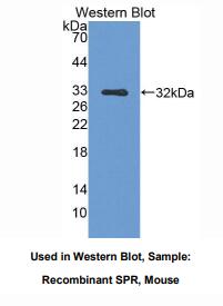 https://msimg.bioon.com/bionline/goods-no-pic.png