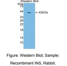 https://msimg.bioon.com/bionline/goods-no-pic.png