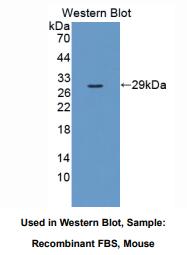 https://msimg.bioon.com/bionline/goods-no-pic.png