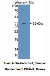 小鼠磷酸甘油酸变位酶2(PGAM2)多克隆抗体