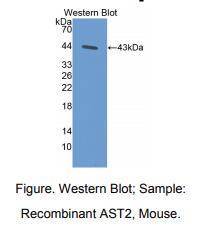 https://msimg.bioon.com/bionline/goods-no-pic.png