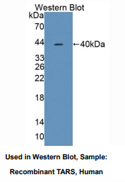 人苏氨酰tRNA合成酶(TARS)多克隆抗体