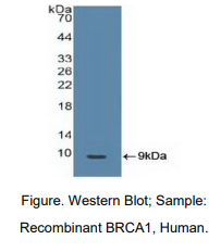 人乳腺癌易感蛋白1(BRCA1)多克隆抗体