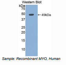 人肌红蛋白(MYO)多克隆抗体
