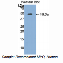 https://msimg.bioon.com/bionline/goods-no-pic.png