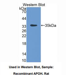 https://msimg.bioon.com/bionline/goods-no-pic.png