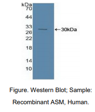 人酸性神经鞘磷脂酶(ASM)多克隆抗体