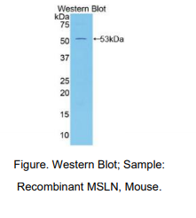 https://msimg.bioon.com/bionline/goods-no-pic.png