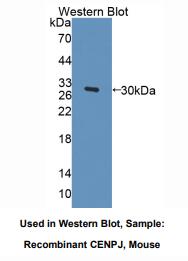 小鼠着丝粒蛋白J(CENPJ)多克隆抗体