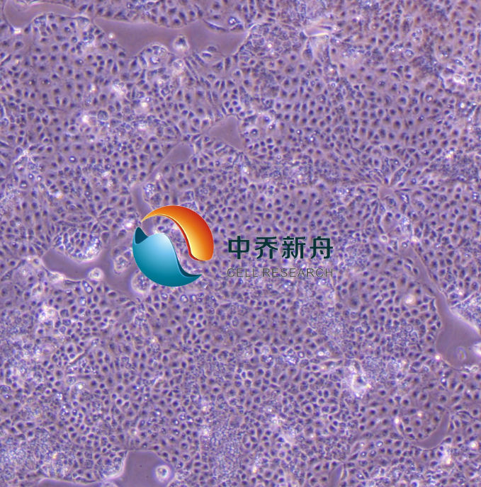 HuH-6人肝母细胞瘤细胞