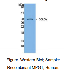 https://msimg.bioon.com/bionline/goods-no-pic.png