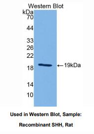 大鼠音猬因子(SHH)多克隆抗体