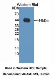 人血小板反应蛋白解整合素金属肽酶19(ADAMTS19)多克隆抗体