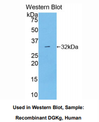 https://msimg.bioon.com/bionline/goods-no-pic.png