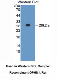 https://msimg.bioon.com/bionline/goods-no-pic.png