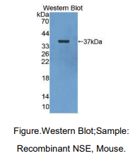 https://msimg.bioon.com/bionline/goods-no-pic.png