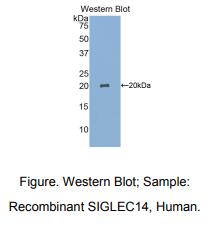 人唾液酸结合Ig样凝集素14(SIGLEC14)多克隆抗体