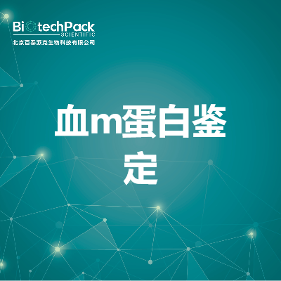https://msimg.bioon.com/bionline/goods-no-pic.png