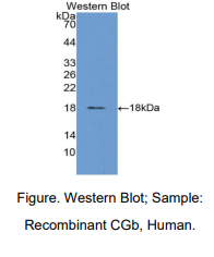 https://msimg.bioon.com/bionline/goods-no-pic.png