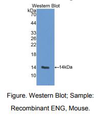 https://msimg.bioon.com/bionline/goods-no-pic.png