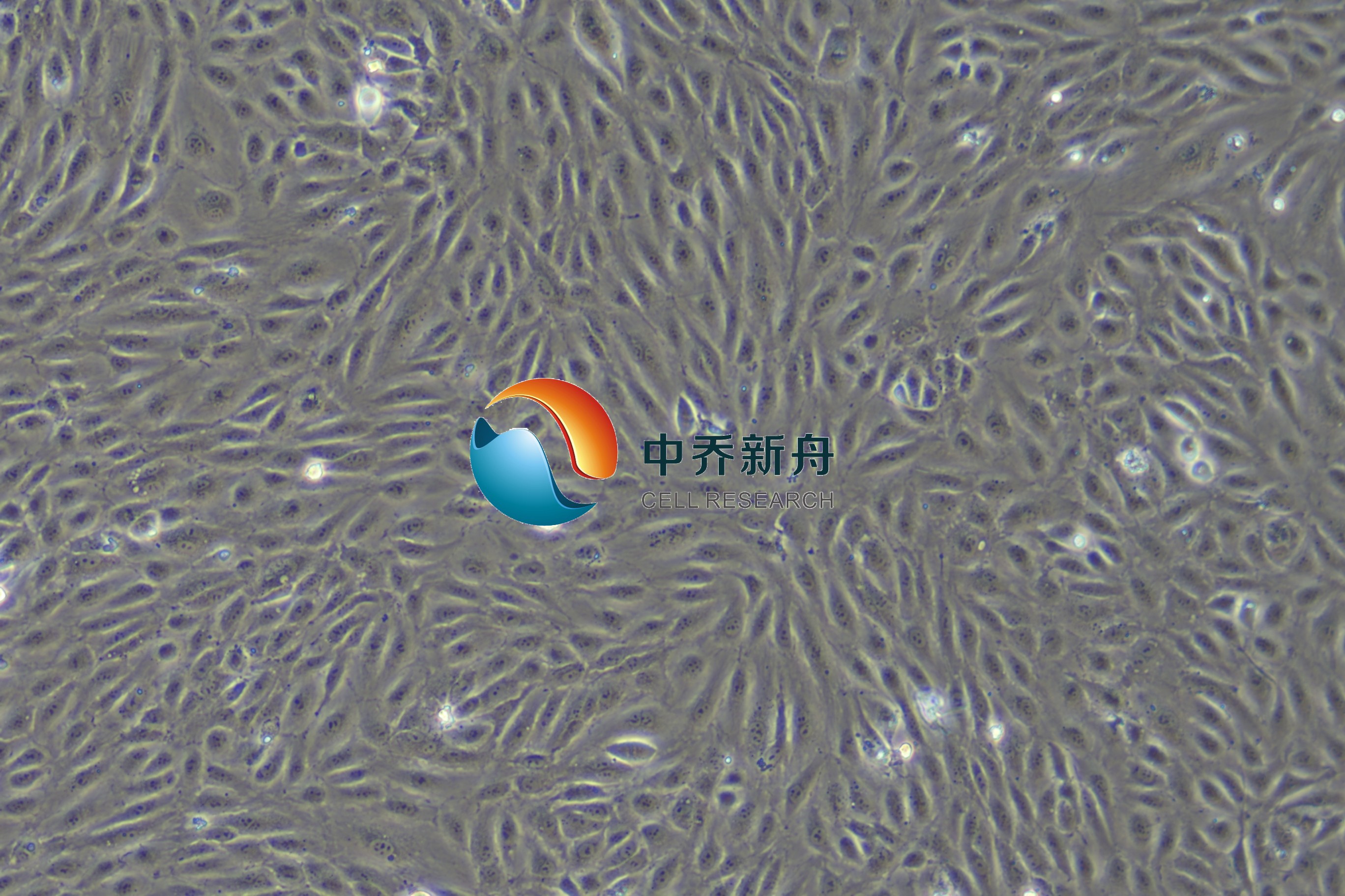 人肾足突细胞