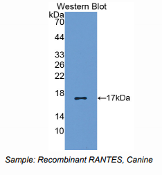 https://msimg.bioon.com/bionline/goods-no-pic.png