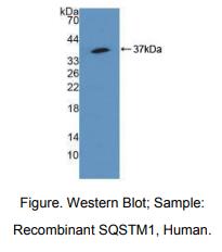 人死骨片1(SQSTM1)多克隆抗体