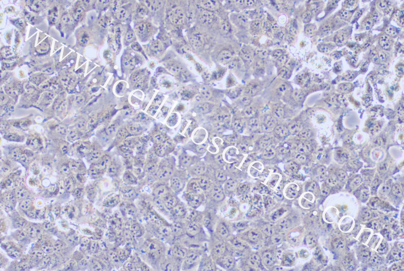 BHT101细胞/BHT-101细胞/BHT101/BHT-101/人甲状腺癌细胞