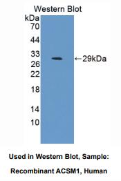 人酰基辅酶A合成酶中链家族成员1(ACSM1)多克隆抗体