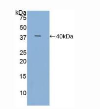 人三叶因子3(TFF3)多克隆抗体