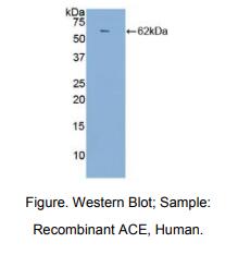 人血管紧张素转化酶(ACE)多克隆抗体