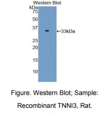 https://msimg.bioon.com/bionline/goods-no-pic.png