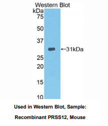 https://msimg.bioon.com/bionline/goods-no-pic.png