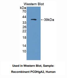 https://msimg.bioon.com/bionline/goods-no-pic.png