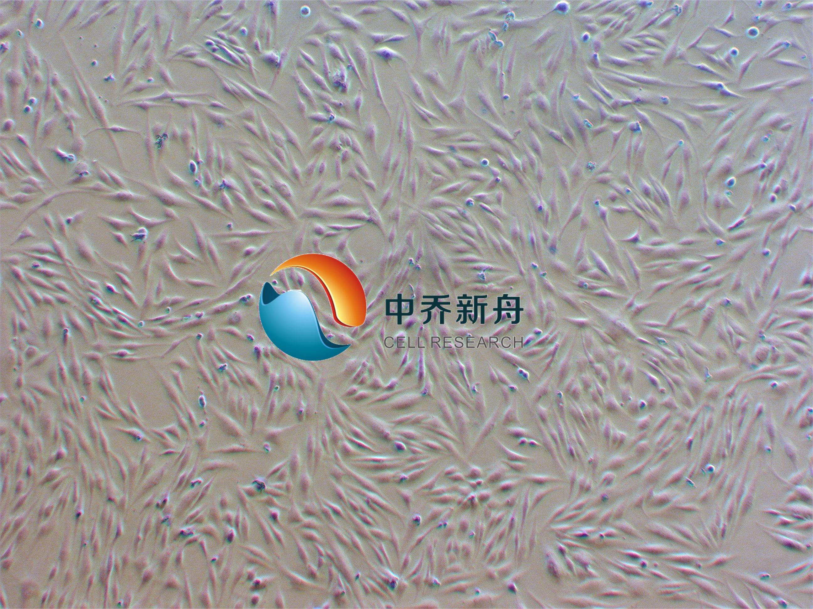 HSF人真皮成纤维细胞-永生化(成人)