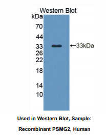 https://msimg.bioon.com/bionline/goods-no-pic.png