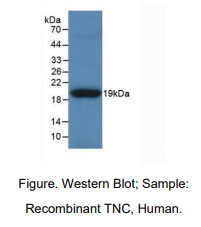 人肌腱蛋白C(TNC)多克隆抗体