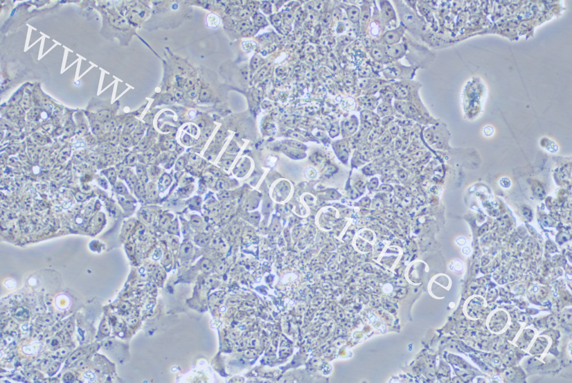 T84细胞/T-84细胞/T-84/T84/人结肠腺癌肺转移细胞