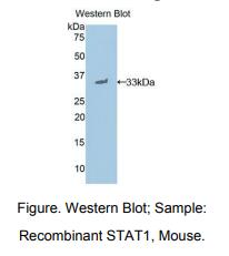 https://msimg.bioon.com/bionline/goods-no-pic.png