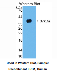 https://msimg.bioon.com/bionline/goods-no-pic.png